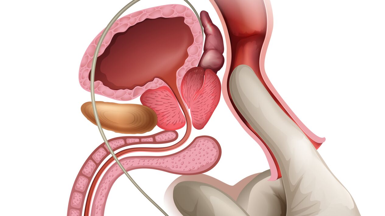 Masaż prostaty jest skuteczną metodą leczenia zastoinowego zapalenia gruczołu krokowego